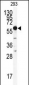 HDAC2 Antibody (C-term)