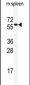 HDAC2 Antibody (C-term)