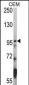 HDAC7 Antibody (C-term)