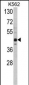 SET07 Antibody (C-term)