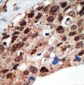 SET7 (SET9) Antibody (Center)