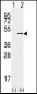 SET7 (SET9) Antibody (Center)