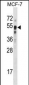 SET7 (SET9) Antibody (Center)