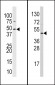 SUV39H2 Antibody (C-term)