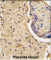 HtrA3 Antibody (N-term)