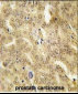 HSP40 Antibody