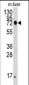 HSPA5 Antibody