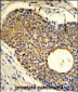 PHO1 Antibody (N-term)