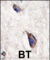 DKK3 Antibody (N-term)