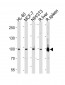 STAT5b Antibody (C-term)