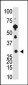 Recoverin Antibody (C-term)