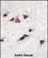 KChIP3 Antibody (N-term M1)