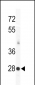 KChIP3 Antibody (N-term M1)