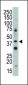 CD33 (SIGLEC3) Antibody (N-term)