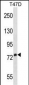 SIGLEC5 Antibody (N-term)