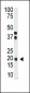 IL28 Antibody (Center)