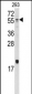 Bmp10 Antibody (N-term)