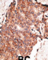 Bmp1 Antibody (C-term)