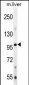 Bmp1 Antibody (C-term)