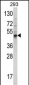 Bmp3 Antibody (N-term)