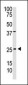 PDGFB Antibody (C-term)