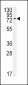 BMPR1A Antibody (N-term K36)