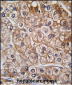 BMPR2 Antibody (N-term)