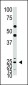 ASCL1 (Achaete-scute homolog 1) Antibody (C-term)