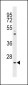 Neurogenin1 (NeuroG1) Antibody (N-term)