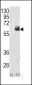 TAU Antibody (C-term)