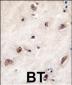 GDF1 Antibody (N-term)