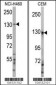 UBE4A Antibody (C-term)