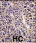 UBE2L6 Antibody (N-term)