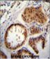 E2EPF Antibody (C-term)