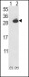 UCHL1 Antibody (N-term)