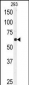 USP3 Antibody (N-term)