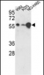 USP3 Antibody (C-term)