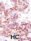 USP4 Antibody (C-term)