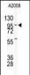 USP5 Antibody (N-term)