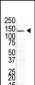 USP8 Antibody (N-term)