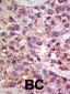 USP11 Antibody (N-term N20)