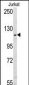 USP11 Antibody (N-term N20)