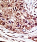 USP14 Antibody (N-term)