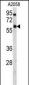 USP14 Antibody (N-term)