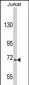 USP19 Antibody (C-term)