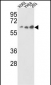 USP21 Antibody (N-term P31)