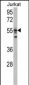 USP22 Antibody (N-term)