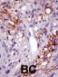 USP22 Antibody (C-term)