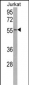 USP22 Antibody (C-term)