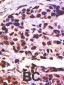 USP25 Antibody (C-term)